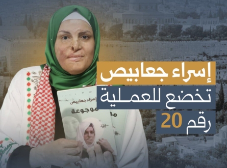 إسراء جعابيص تخضع للعملية رقم 20