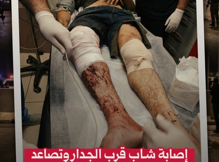 إصابة شاب قرب الجدار وتصاعد الاعتداءات الليلة في القدس